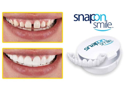 ✨ ¡Oferta 3x1! Carillas Dentales Snap On Smile: Sonrisa Perfecta al Instante 😁